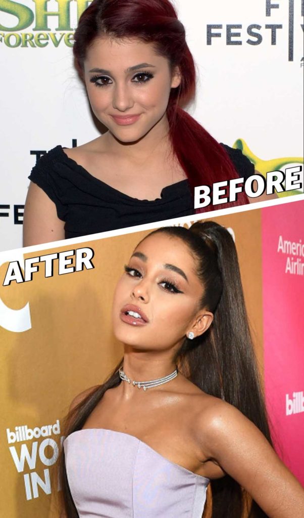 13 Celebrities Before and After Going Vegan